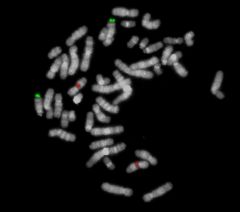  MetaSystems™ CL CCND1/IGH DNA Probe