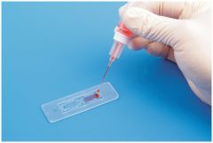 Biomedical Polymers LeukoChek™ Leukocyte Test Kit