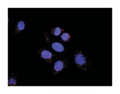  anti-HDAC2, HDAC1 Protein Protein Interaction Antibody Pair, Abnova™