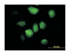  zinc finger protein 74, Mouse, Polyclonal Antibody, Abnova™
