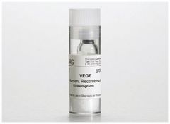 Corning™ Vascular Endothelial Growth Factor (VEGF), Human Recombinant