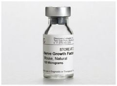 Corning™ 2.5S Nerve Growth Factor (NGF), Mouse Natural
