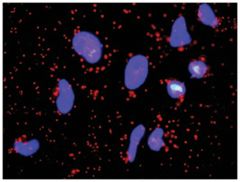  anti-FGFR2, FGF1 Protein Protein Interaction Antibody Pair, Abnova™