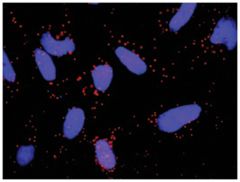  anti-FGFR1, FGF8 Protein Protein Interaction Antibody Pair, Abnova™
