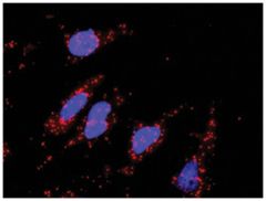  anti-DKK1, CTNNB1 Protein Protein Interaction Antibody Pair, Abnova™