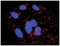  anti-RELB, RELA Protein Protein Interaction Antibody Pair, Abnova™