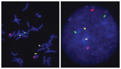 Abnova™ 3-Color FISH Probe (chromosome 13, 18 and 21)