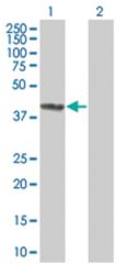  NR0B1 293T Cell Overexpression Lysate (Denatured), Abnova