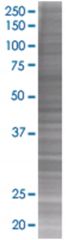  NUDT2 293T Cell Overexpression Lysate (Denatured), Abnova