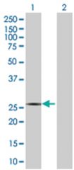 RND3 293T Cell Overexpression Lysate (Denatured), Abnova