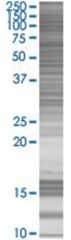  PHOX2A 293T Cell Overexpression Lysate (Denatured), Abnova