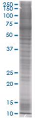  BDNF 293T Cell Overexpression Lysate 1 (Denatured), Abnova