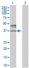  BSG 293T Cell Overexpression Lysate (Denatured), Abnova