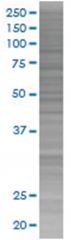  C1S 293T Cell Overexpression Lysate (Denatured), Abnova