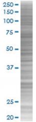  RUNX1T1 293T Cell Overexpression Lysate (Denatured), Abnova