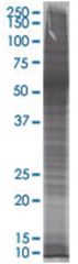  CD14 293T Cell Overexpression Lysate 1 (Denatured), Abnova
