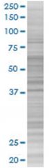  MS4A1 293T Cell Overexpression Lysate (Denatured), Abnova