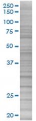  CD80 293T Cell Overexpression Lysate (Denatured), Abnova
