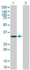  CDK5 293T Cell Overexpression Lysate 2 (Denatured), Abnova