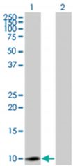  DDT 293T Cell Overexpression Lysate (Denatured), Abnova