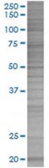  DUSP3 293T Cell Overexpression Lysate (Denatured), Abnova