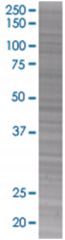  DUSP6 293T Cell Overexpression Lysate (Denatured), Abnova