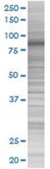  EPS8 293T Cell Overexpression Lysate (Denatured), Abnova