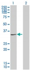  EXTL2 293T Cell Overexpression Lysate (Denatured), Abnova