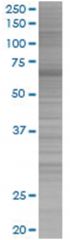  BRF1 293T Cell Overexpression Lysate (Denatured), Abnova