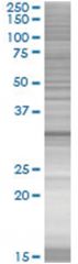  HOXC8 293T Cell Overexpression Lysate (Denatured), Abnova