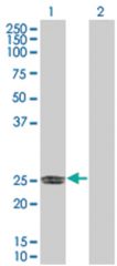  ERAS 293T Cell Overexpression Lysate (Denatured), Abnova