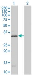  HTR1E 293T Cell Overexpression Lysate (Denatured), Abnova