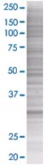  HUS1 293T Cell Overexpression Lysate (Denatured), Abnova