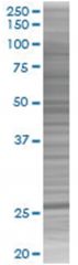  HYAL1 293T Cell Overexpression Lysate (Denatured), Abnova