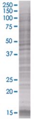  ICAM2 293T Cell Overexpression Lysate (Denatured), Abnova