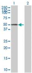  JUNB 293T Cell Overexpression Lysate (Denatured), Abnova