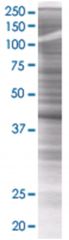  2-SEP 293T Cell Overexpression Lysate (Denatured), Abnova