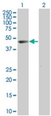  OAS1 293T Cell Overexpression Lysate (Denatured), Abnova
