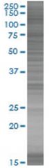  ORC1L 293T Cell Overexpression Lysate (Denatured), Abnova