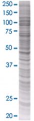  ORM1 293T Cell Overexpression Lysate (Denatured), Abnova