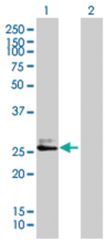  KLK7 293T Cell Overexpression Lysate 1 (Denatured), Abnova