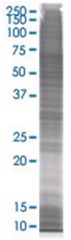  S100A7 293T Cell Overexpression Lysate (Denatured), Abnova