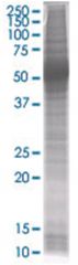  S100A8 293T Cell Overexpression Lysate (Denatured), Abnova