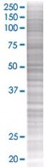  SCTR 293T Cell Overexpression Lysate (Denatured), Abnova