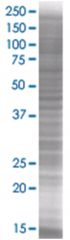  SECTM1 293T Cell Overexpression Lysate 2 (Denatured), Abnova