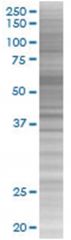  SELP 293T Cell Overexpression Lysate (Denatured), Abnova