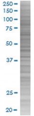  SLC11A1 293T Cell Overexpression Lysate (Denatured), Abnova
