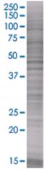  SLC14A1 293T Cell Overexpression Lysate (Denatured), Abnova