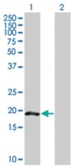 SUMO3 293T Cell Overexpression Lysate (Denatured), Abnova