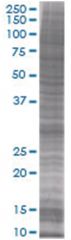  SNAI1 293T Cell Overexpression Lysate 1 (Denatured), Abnova